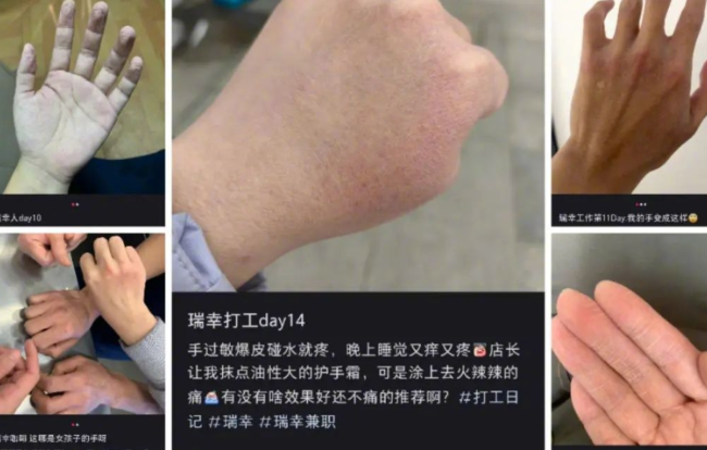 瑞幸员工：太好了！我的手有救了！！
