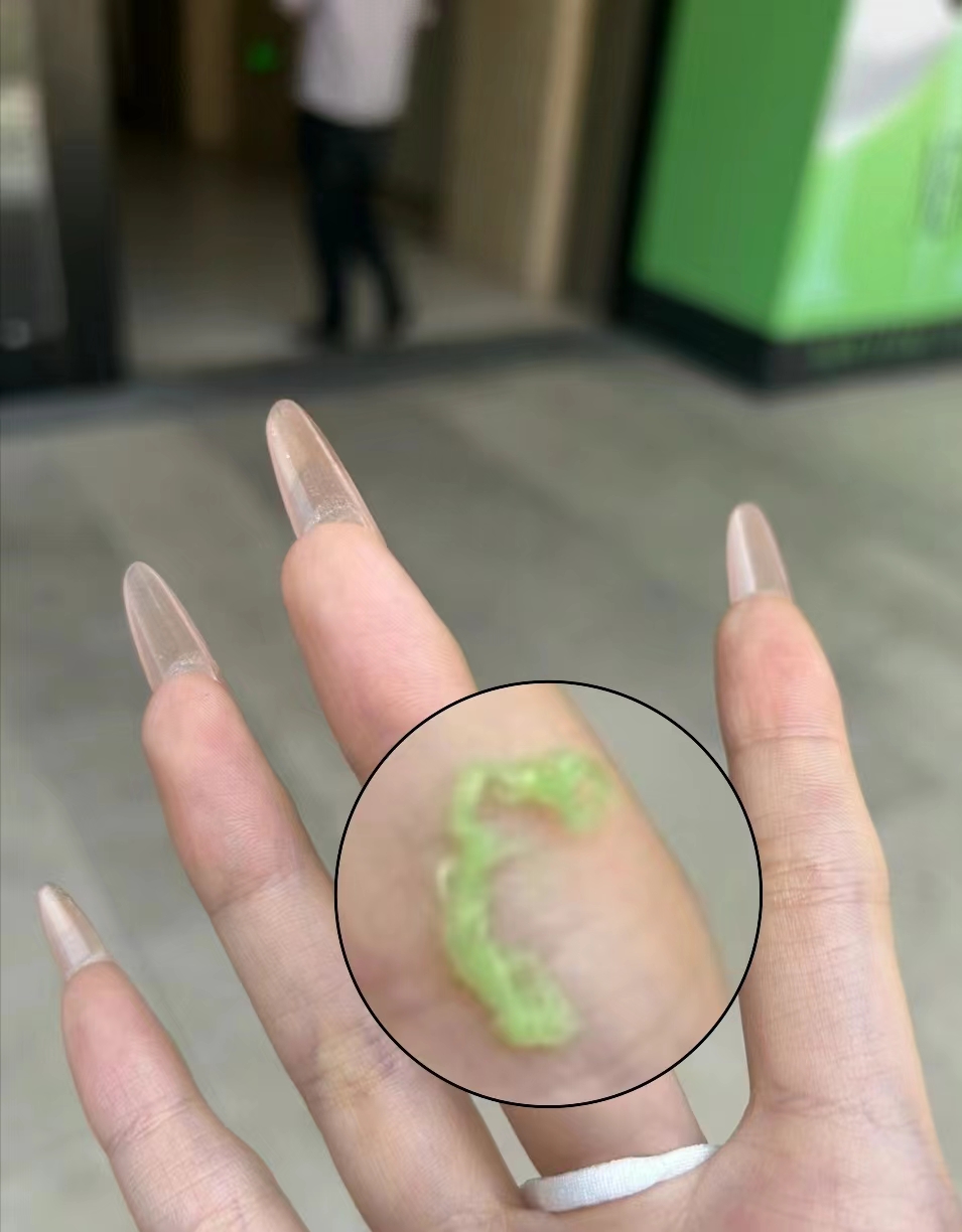 瑞幸咖啡喝出毛巾边？！客服回应：是果肉纤维