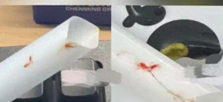 古茗被曝喝到血痰？！市监管：无法认定